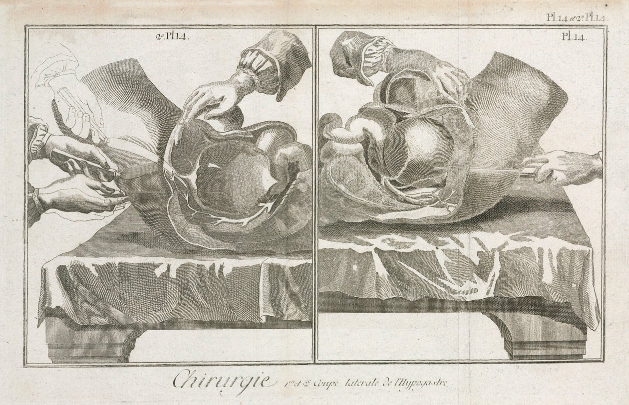 Équipement, chirurgie abdominale de l