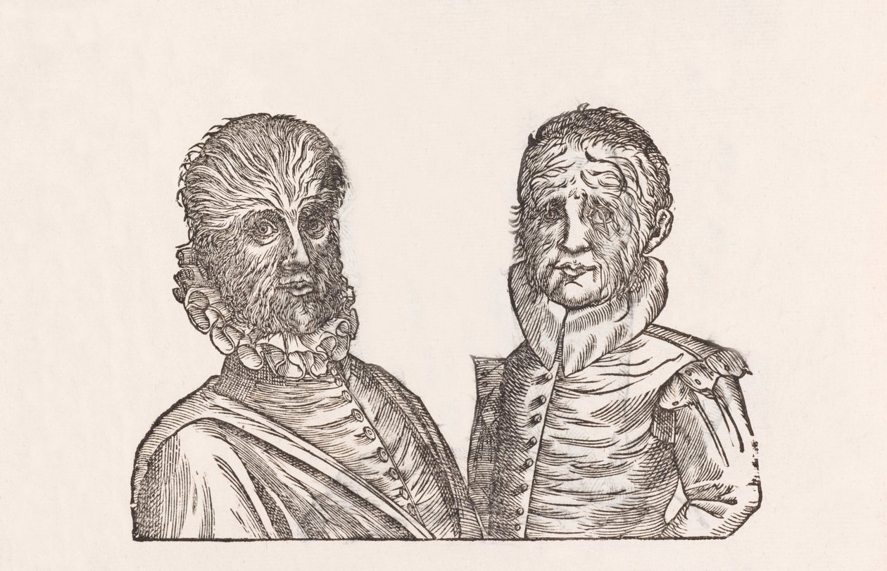 Pater annorum quadragina, & filus annorum viginti toto corpore pilosi - Unbekannt