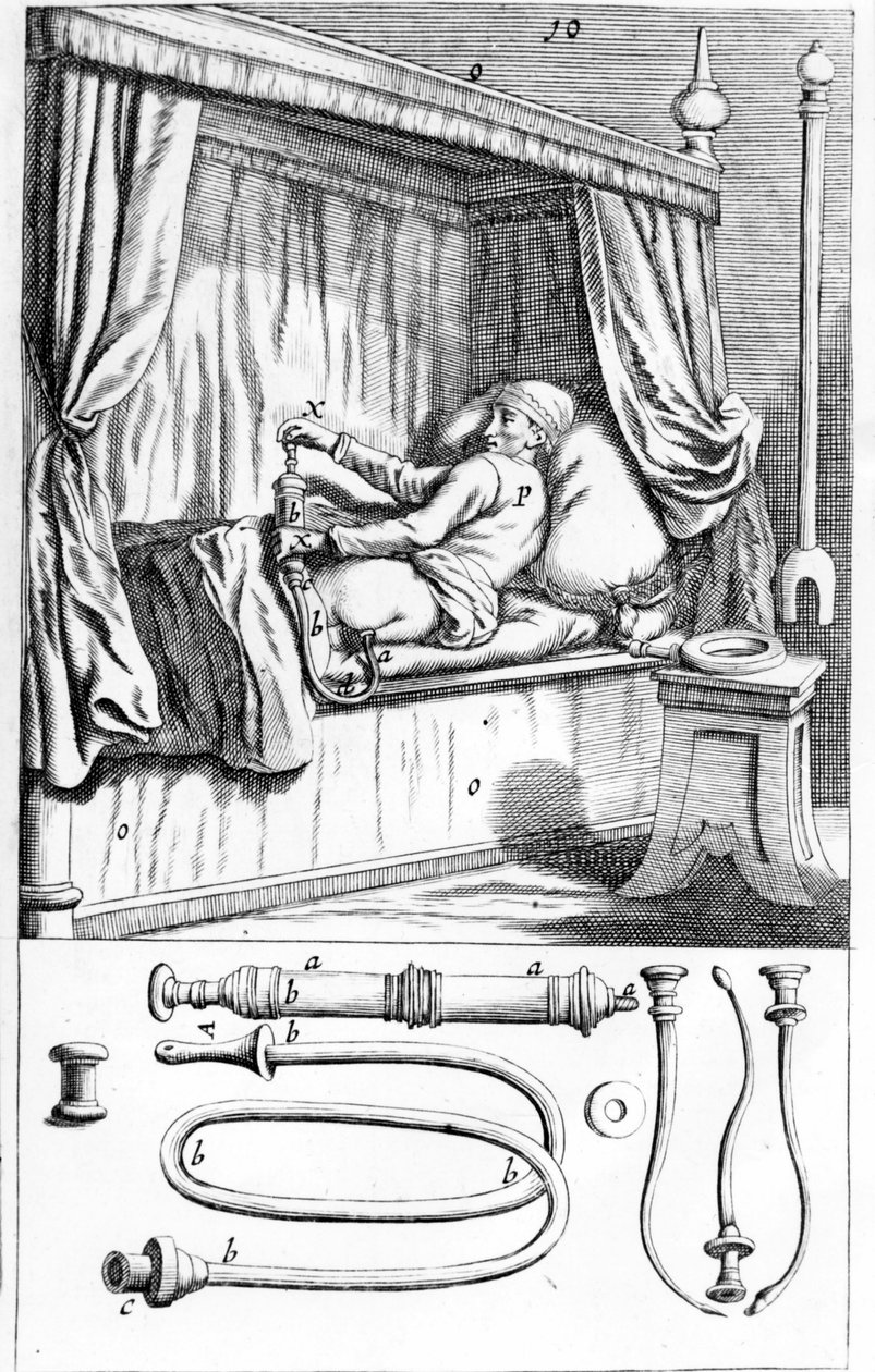 Clystère (pour lavements) par Johannes Sculptetus « Armamentarium ...