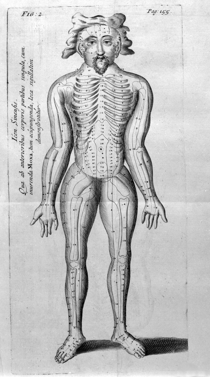 De Acupunctura par W.Ten Rhijne. Londres 1683. Premier texte occidental traitant de l