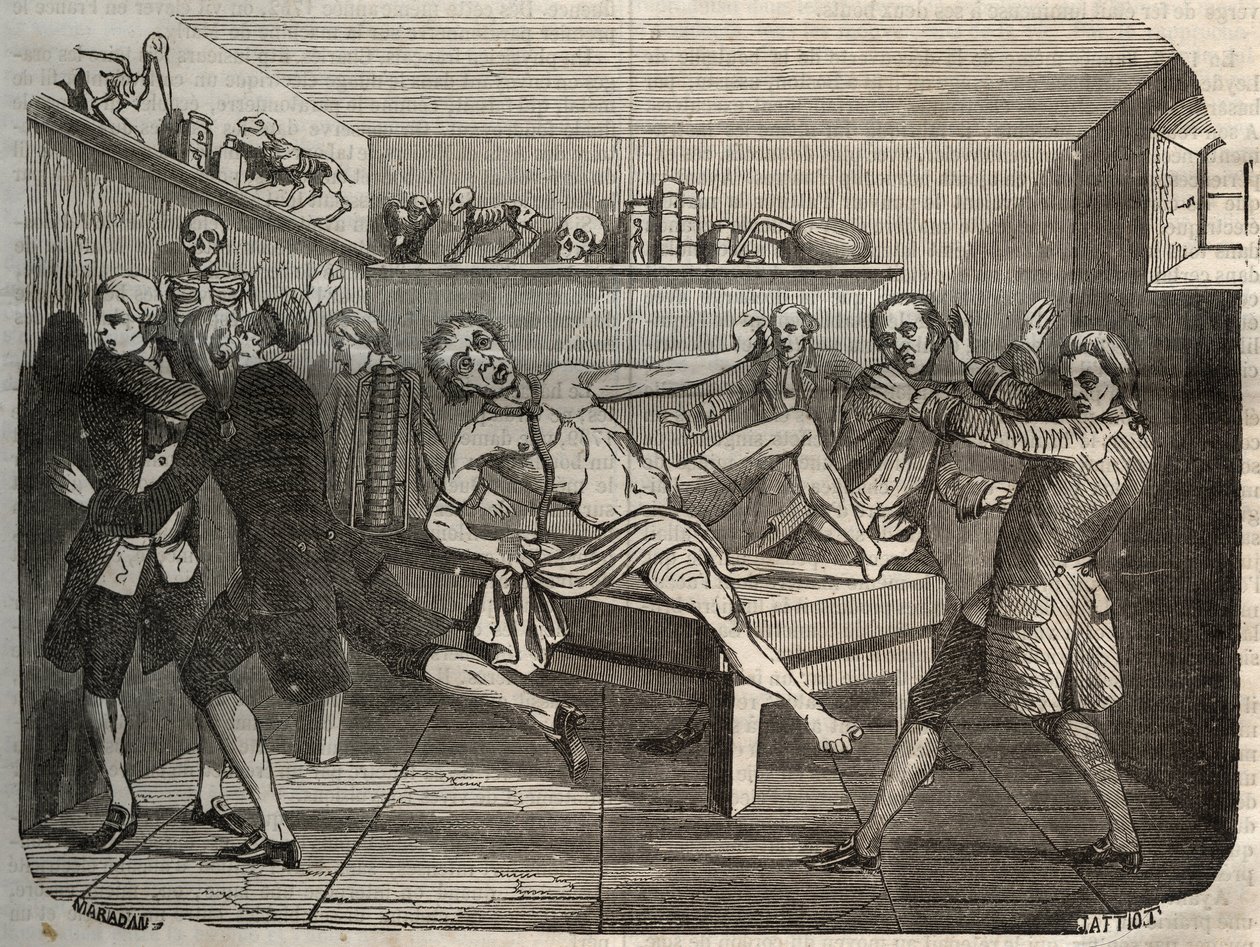 Galvanisation du cadavre d