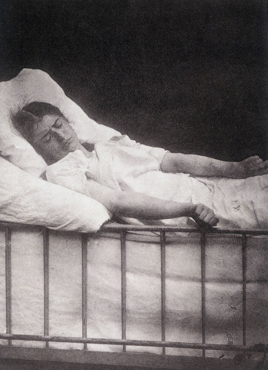Hystéro-épilepsie - Attaque de tétanisme dans « Iconographie photographique de la Salpêtrière : service de M. Charcot » par Paul Regnard et Bourneville - Unknown artist