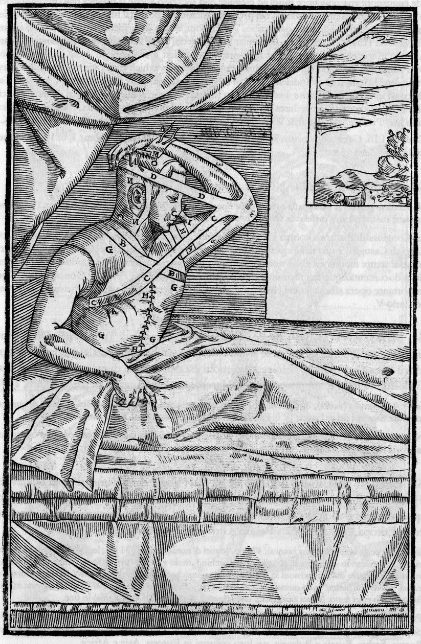 Chirurgie du nez : Chirurgie reconstructive du nez dans « De curtorum chirurgia per insitionem ». Venise - Unknown artist