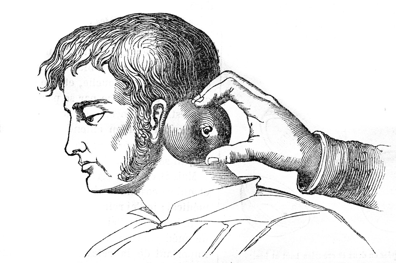 Saignée locale - application de sangsues avec une pomme - gravure dans « La Santé Universelle - Guide Médical des Familles » 1852 - Unknown artist