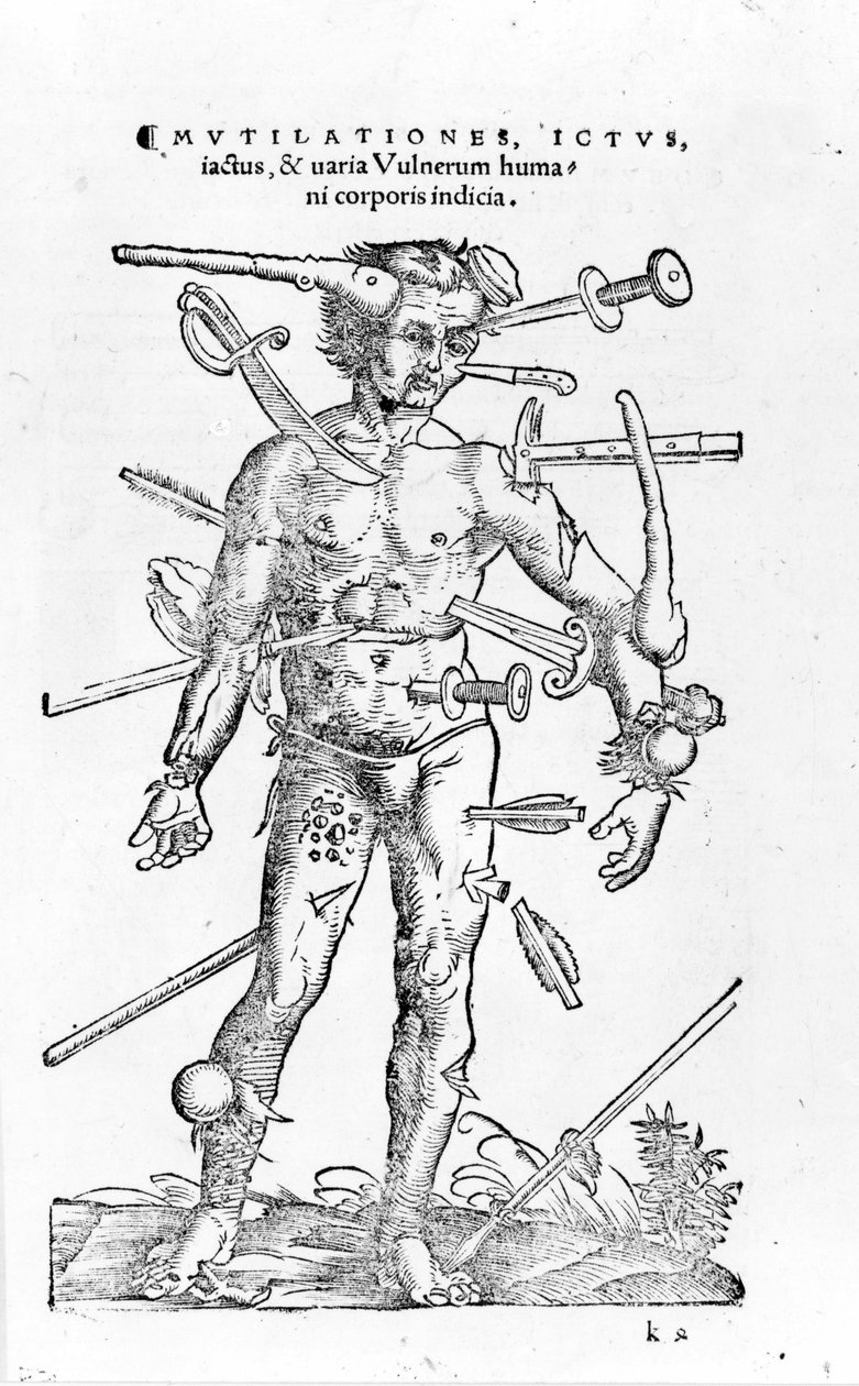 Toutes sortes de blessures de guerre traumatiques. 16ème siècle - Unknown artist