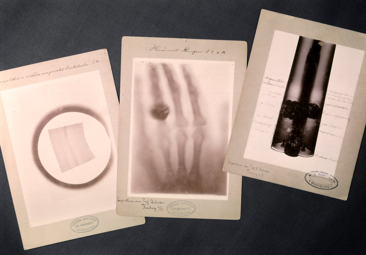 Radiographies originales de Roentgen (radiographie)