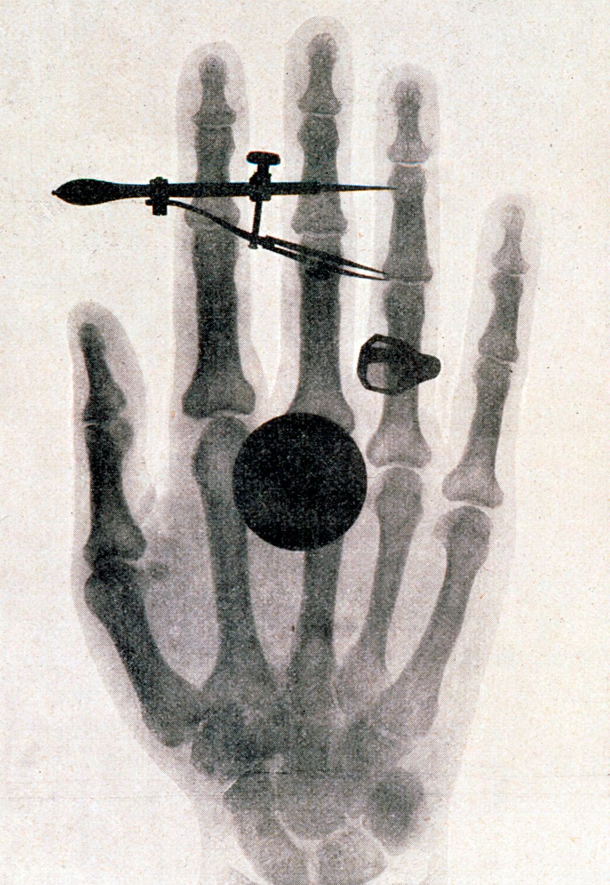 Radiographie de la main de la femme de Wilhelm Roentgen, 1896 - Wilhelm Conrad Rontgen