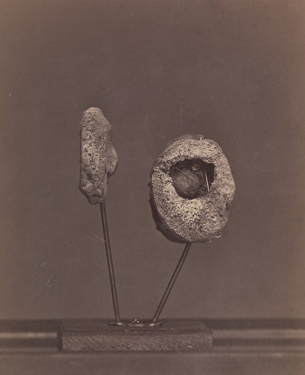 Articulation du genou excisée. Une balle de mousquet ronde dans le condyle interne du fémur droit - William H. Bell