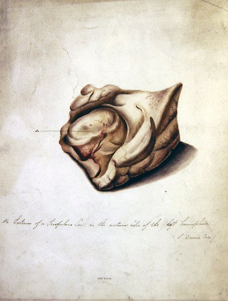 Étude du cerveau II, vers 1850 - William Lover