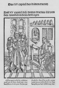 Le Livre de Cirurgia par Hieronymus Brunschwig - (after) German School
