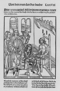 Le Livre de Cirurgia par Hieronymus Brunschwig (lithographie) - (after) German School