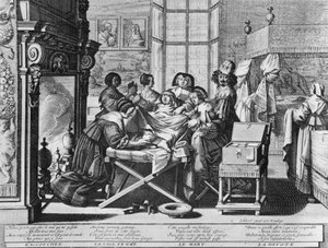Série de gravures (eau-forte) intitulée « Le Mariage à la Ville » de 1633 par Abraham Bosse - « Accouchement » : sur le lit de travail - Abraham Bosse