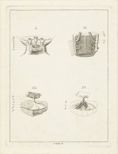 Coupes de plantes