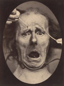 Électro-Physiologie, Figure 64, 1854-56, imprimé en 1862 - Adrien Alban Tournachon