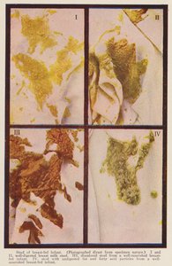Selles de nourrissons allaités (photo en couleur) - American Photographer