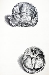 Les Planches du Septième Livre de De Humani Corporis Fabrica - Andreas Vesalius