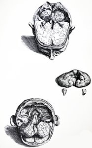 Les planches du septième livre de De Humani Corporis Fabrica - Andreas Vesalius