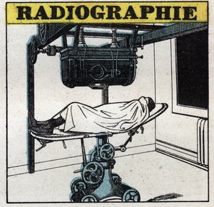 Rayons X : appareil à rayons X. Illustration anonyme de 1925. Collection privée.
