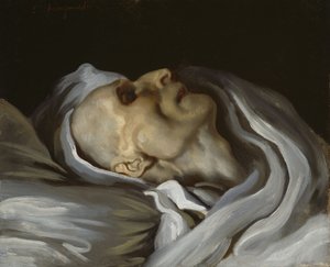 Théodore Géricault sur son lit de mort - Charles Emile Callande de Champmartin