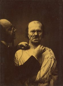 Agression, méchanceté, 1854-1856, imprimé 1862 - Duchenne de Boulogne