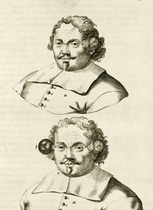 Un exemple de ventouses, de Exercitationes Practicae circa Medendi Methodum par Frederik Dekkers, 1694 - Dutch School