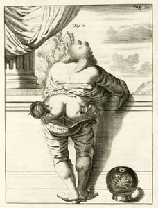 Un exemple de ventouses, de Exercitationes Practicae circa Medendi Methodum par Frederik Dekkers, 1694 - Dutch School
