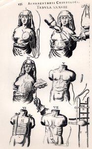 Opération sur un cancer du sein, de Armamentarii Chirurgici par Johannes Schultes (1595-1645) publié à Amsterdam, 1672 - Dutch School