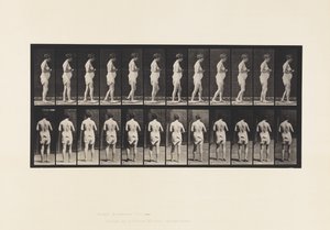 Planche 542. Sclérose cérébro-spinale multiple - Marche - Eadweard Muybridge