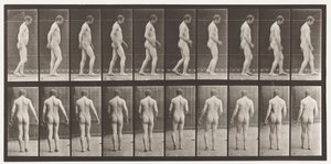 Planche 553. Après traumatisme crânien ; marche - Eadweard Muybridge