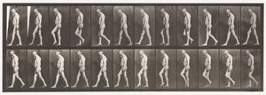 Planche 555. Atrophie musculaire des jambes; adulte, A,B, marche, 1885