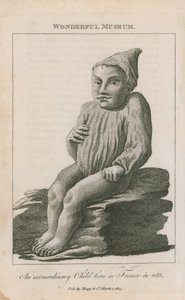 Un enfant extraordinaire né en France en 1683 - English School
