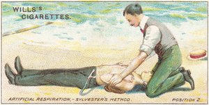 Respiration artificielle, méthode Sylvester - Position 2, no.17 de la série Premiers Secours des cartes de cigarettes Willss, 1913