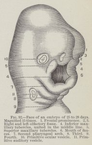 Visage d