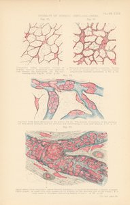 Augmentation du bioplasme normal, fièvre (litho couleur) - English School