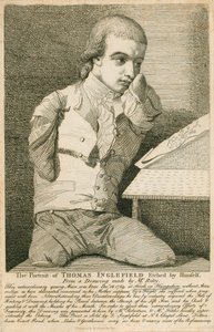 Thomas Inglefield, né le 18 décembre 1769 à Hook, Hampshire, sans bras ni jambes - English School
