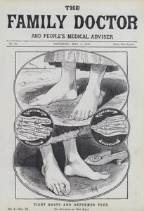 Bottes serrées et pieds déformés