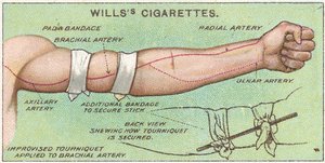 Garrot, no.11 de la série Premiers Secours des cartes de cigarettes Willss, 1913
