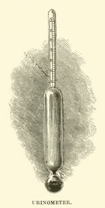Urinomètre (gravure) - English School