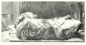 Tintoretto au chevet de sa fille - European School