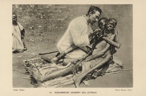 Missionnaire soignant des lépreux - French Photographer