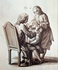 Un médecin opérant un patient atteint de cataracte, illustration de l