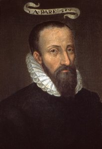 Ambroise Paré. XVIe siècle - French School