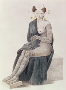 Ichtyose congénitale, d