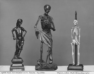 Cadavre, squelettes