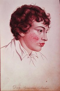 Tache sèche, de 