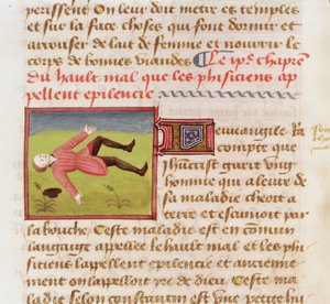 Ms 22532 Patient souffrant d