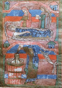 Femme hydropique guérie par les bains de Sainte Radegonde, de La Vie de Sainte Radegonde