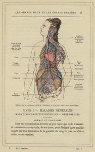 Organes de la production et de la circulation du sang chez une femme chlorotique - French School