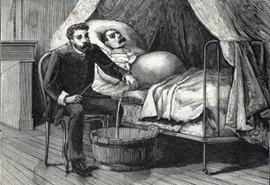 Patient avec cirrhose hépatique avancée, docteur effectuant une ponction (gravure) 1888 - French School