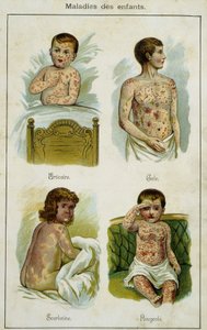 Planche illustrant les maladies infantiles : urticaire, gale, scarlatine et rougeole (tirée de Bilz, médication naturelle) fin du XIXe siècle - French School